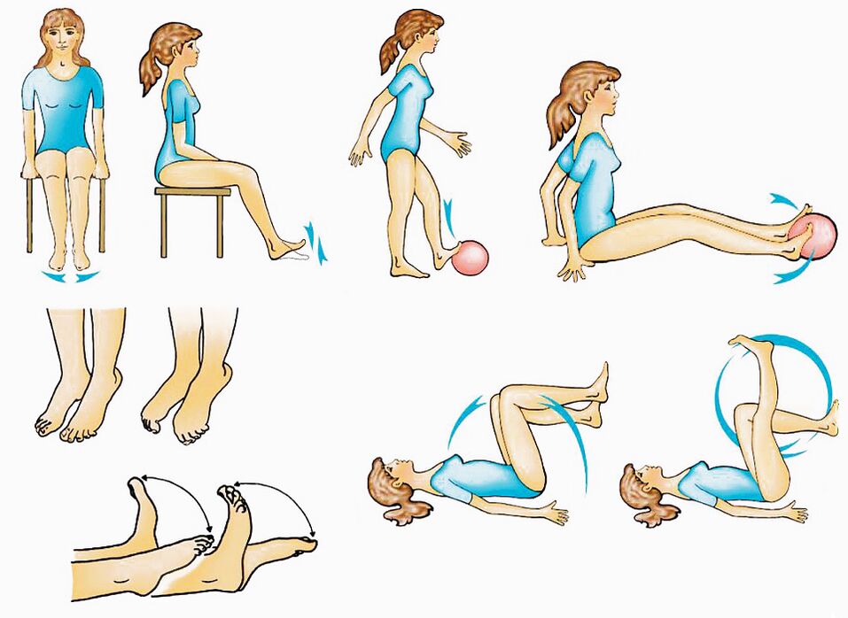 Physical training for varicose veins