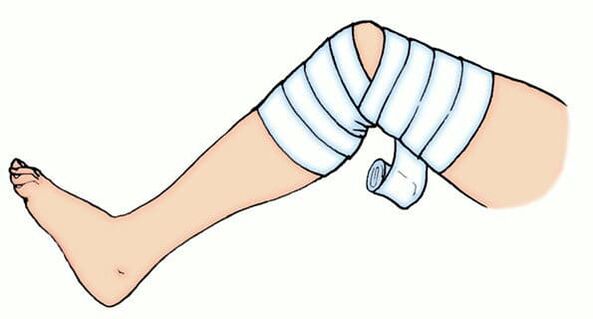 Elastic